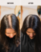 Scalp Topper Hair Extensions For Women | Natural Look Hair Volume & Coverage - Image 3